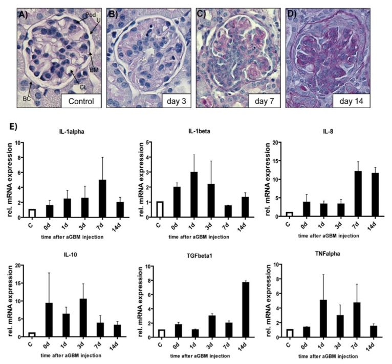 Role of the anti-GBM nephritis model in cytokine activation and its functional differences. (OA Literature)