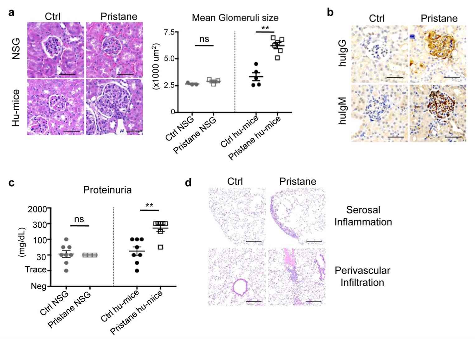 The experimental results of lupus nephritis and pulmonary inflammation. (OA Literature)