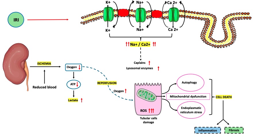 Pathophysiological pictures of ischemia–reperfusion injury (IRI). (OA Literature)