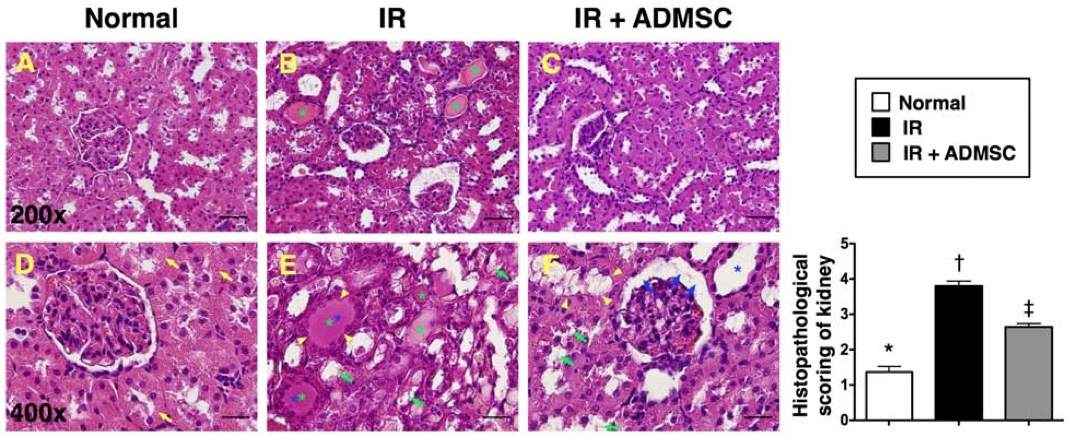 Histopathological pictures of ischemia-reperfusion (IR)-induced renal injury. (OA Literature)