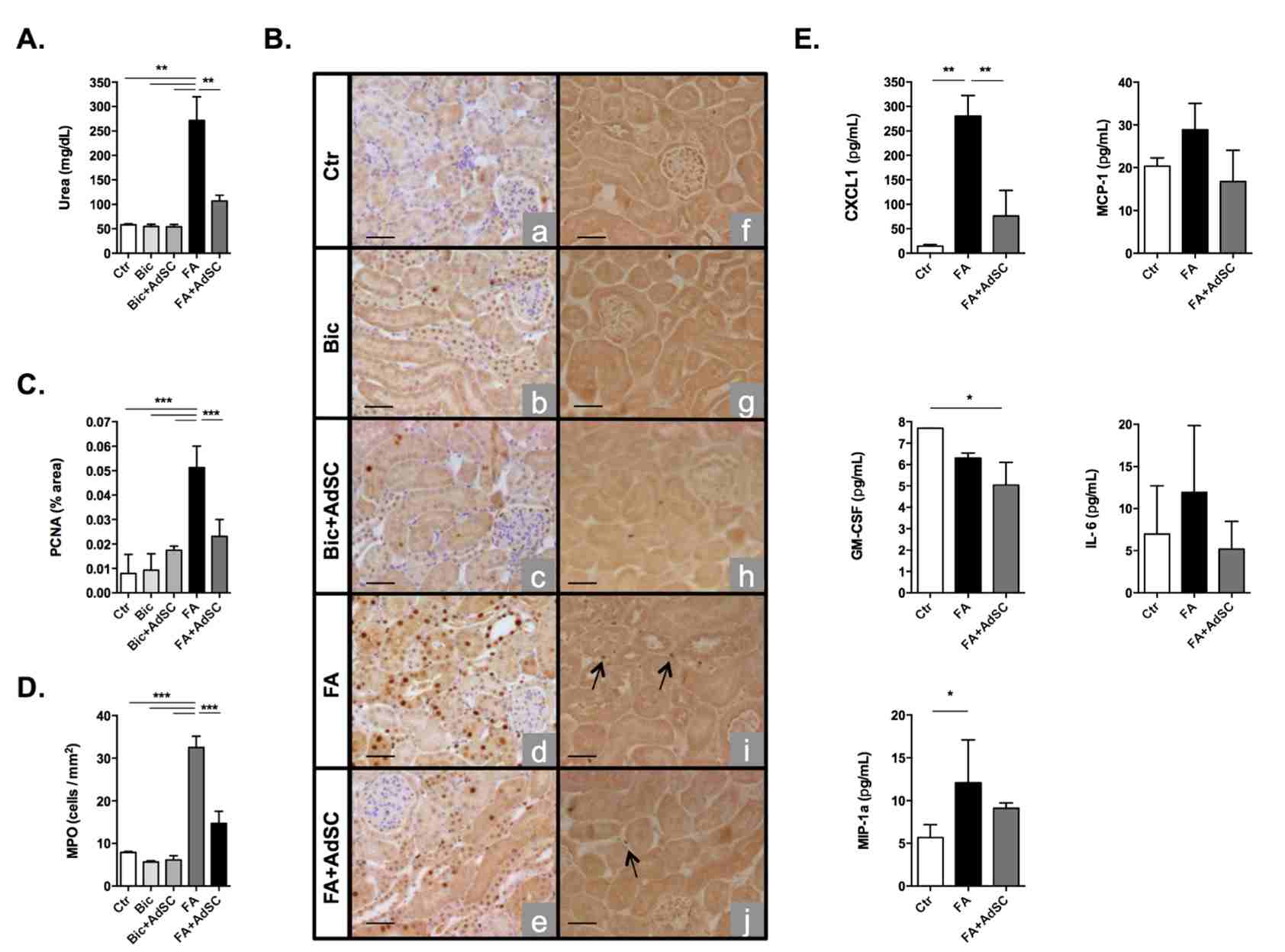 Acute kidney injury induced by folic acid. (OA Literature)