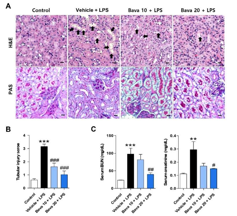 Bavachin improves histological alterations and renal function in mice with LPS-induced AKI. (OA Literature)