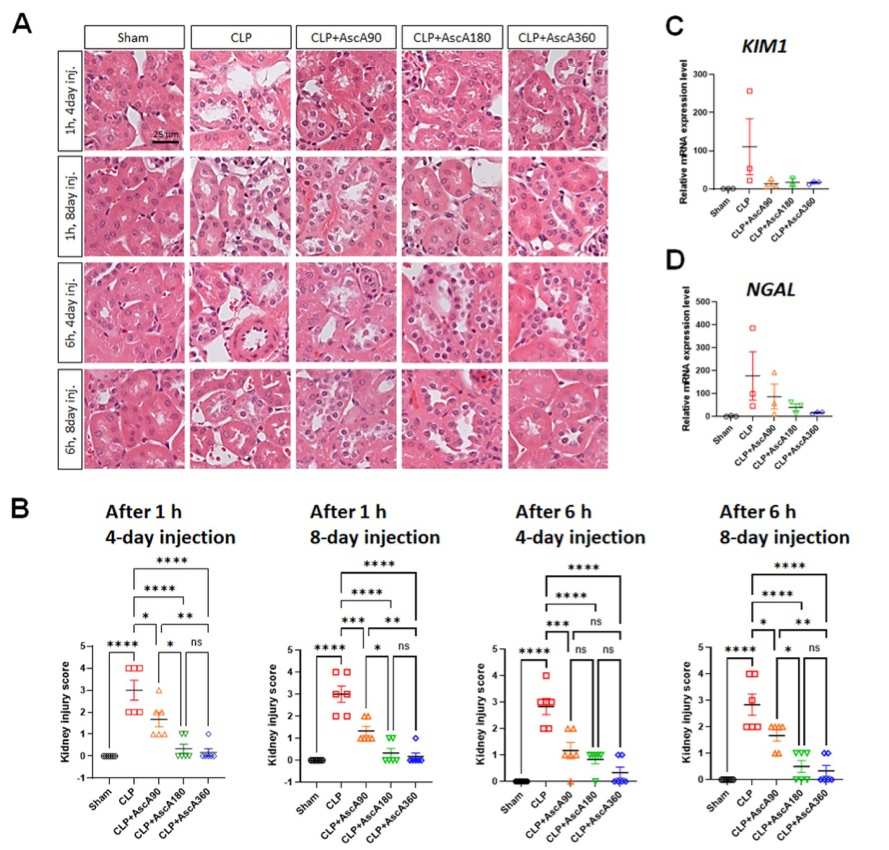 Cecal ligation and puncture (CLP) induces acute kidney injury in mice. (OA Literature)