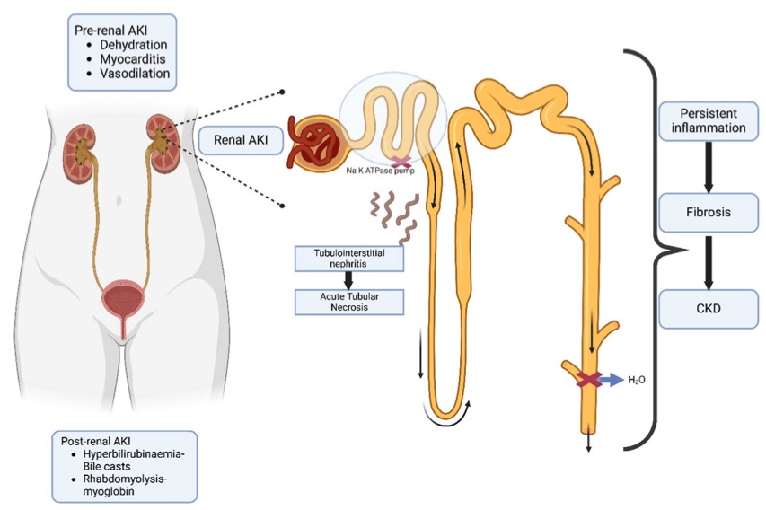 Pathophysiological mechanisms of acute kidney injury and chronic kidney disease in leptospirosis. (OA Literature)