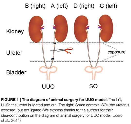 The schematic of the surgical procedure for inducing the UUO model in animals. (OA Literature)