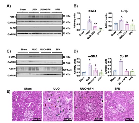 Sulforaphane (SFN) alleviates renal injury in the unilateral ureteral obstruction model. (OA Literature)