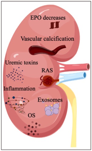 Diagram of chronic kidney disease pathogenesis. (OA Literature)
