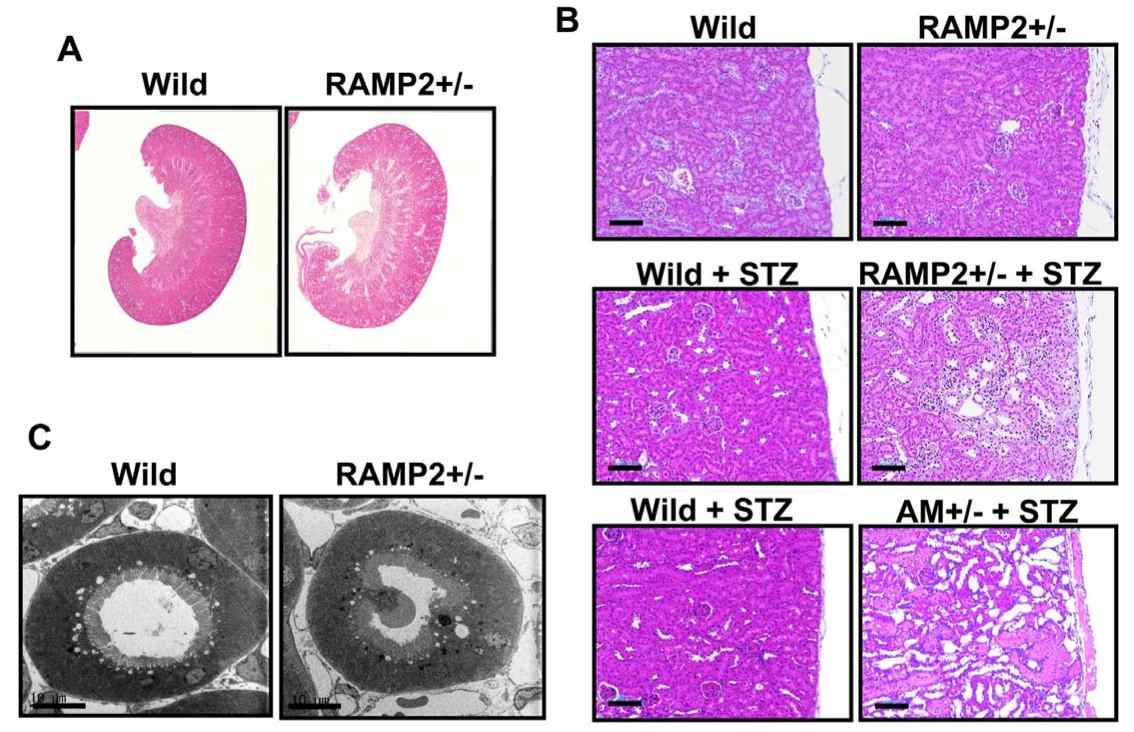 Pictures of renal tubular changes in the STZ-induced diabetic nephropathy model. (OA Literature)