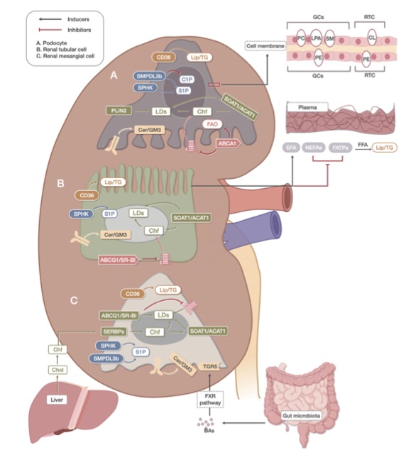 Diagram of lipid metabolism changes in DKD. (OA Literature)