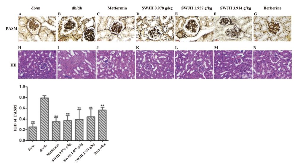 Impact of SWJH on renal histological and ultrastructural changes. (OA Literature)
