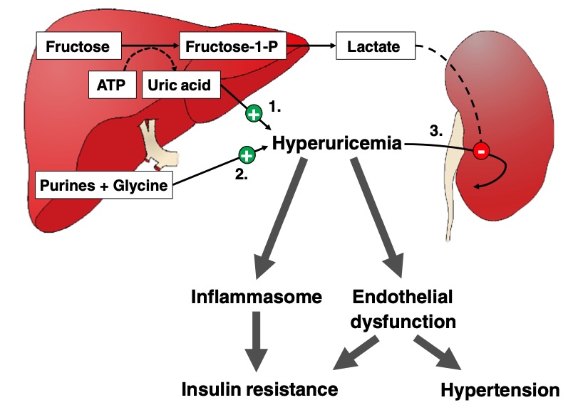 Possible harmful effects of fructose-induced hyperuricemia. (OA Literature)