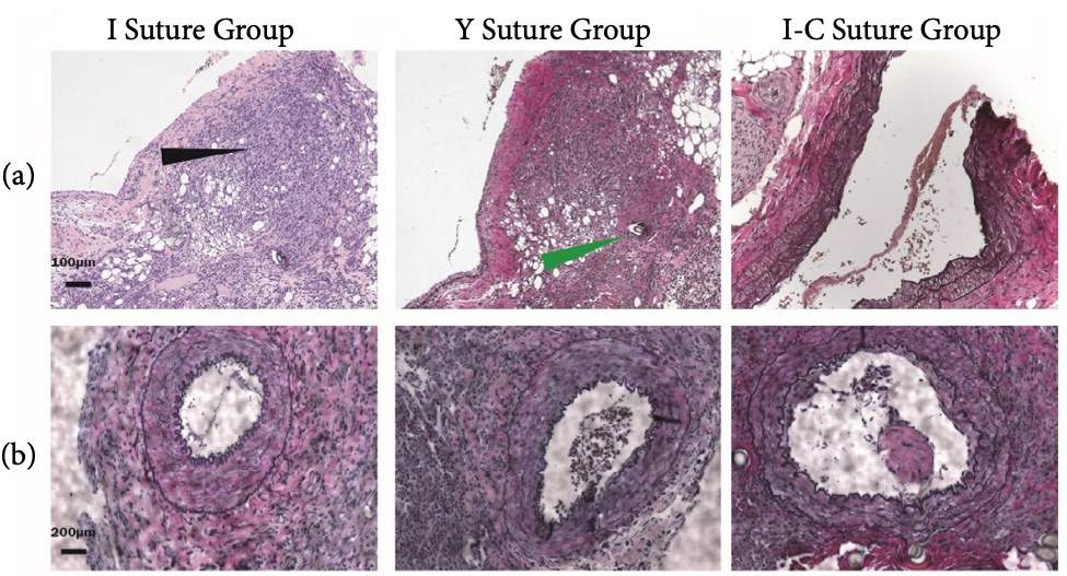 The histopathological pictures of arterial walls on day 7 post-operationally. (OA Literature)
