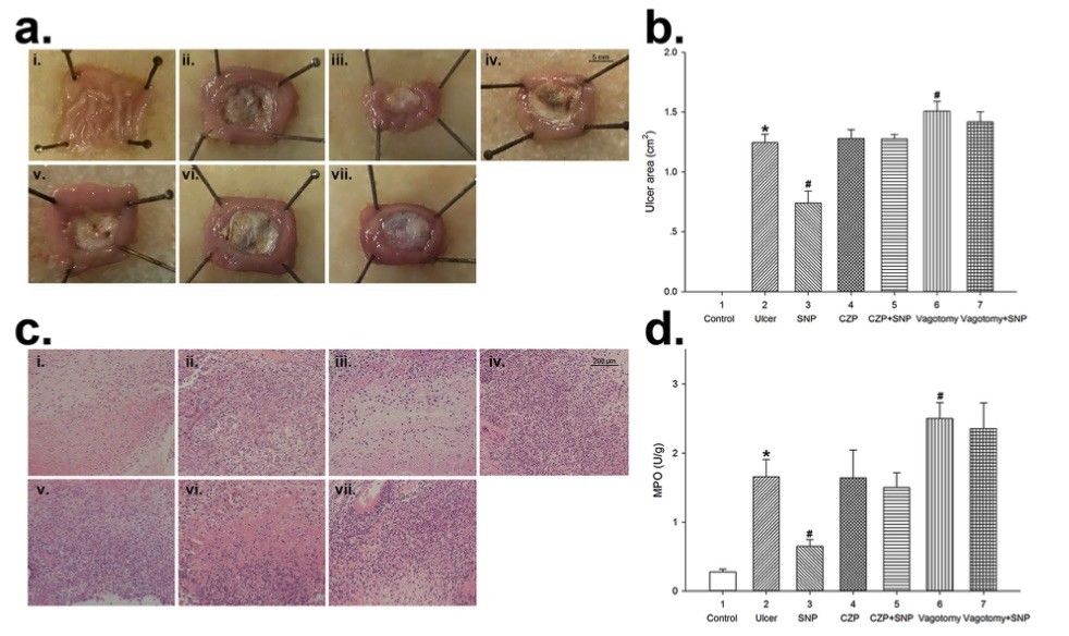 Fig.1 Sodium nitroprusside (SNP) reduced acetic acid-induced gastric ulcers in rats, with the effect being mediated through TRPV1 and the vagus nerve. (OA Literature)