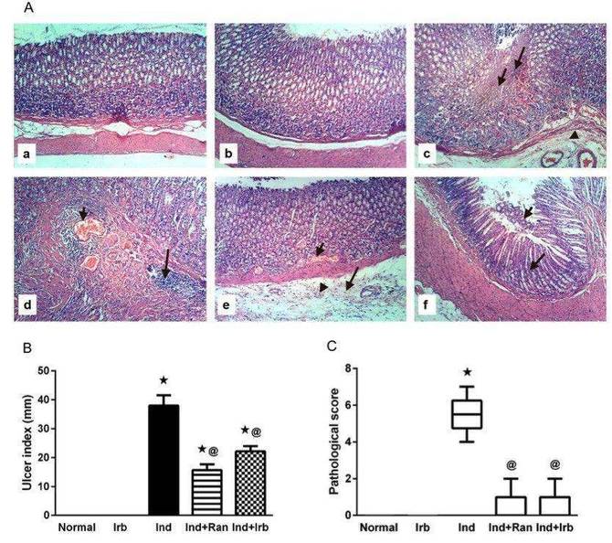 Fig.1 A picture showing the effect of irbesartan on gastric mucosal damage induced by indomethacin in rats. (OA Literature)
