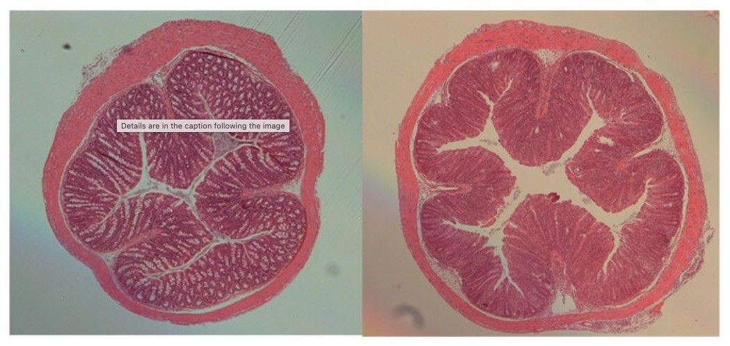 Fig.1 A picture of the bowel wall in mouse T cell transfer–induced colitis. (OA Literature)