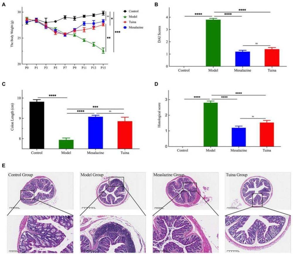 Fig.2 A picture showing tuina treatment prevents UC-related symptoms in model mice. (OA Literature)