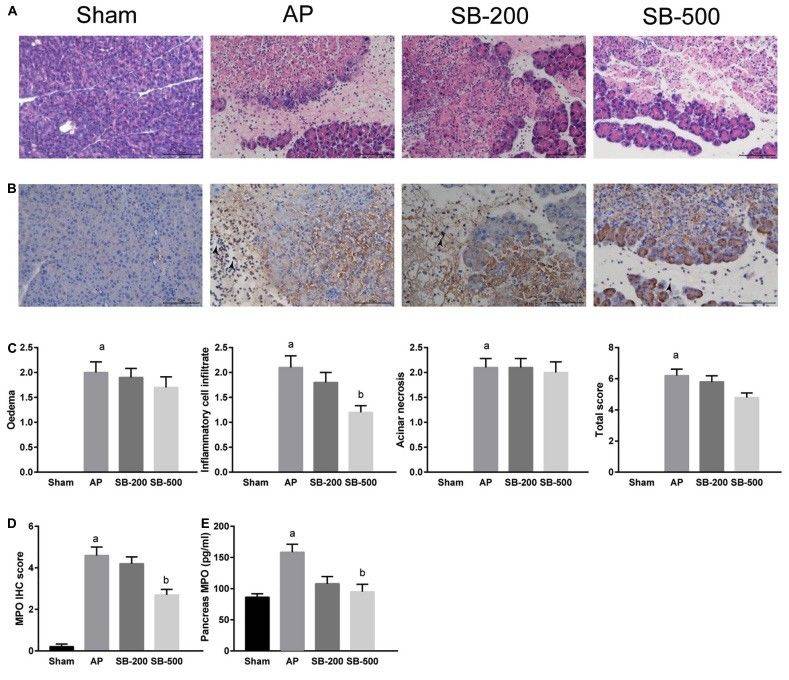 Fig.1 A picture of the bowel wall in mouse T cell transfer–induced colitis. (OA Literature)