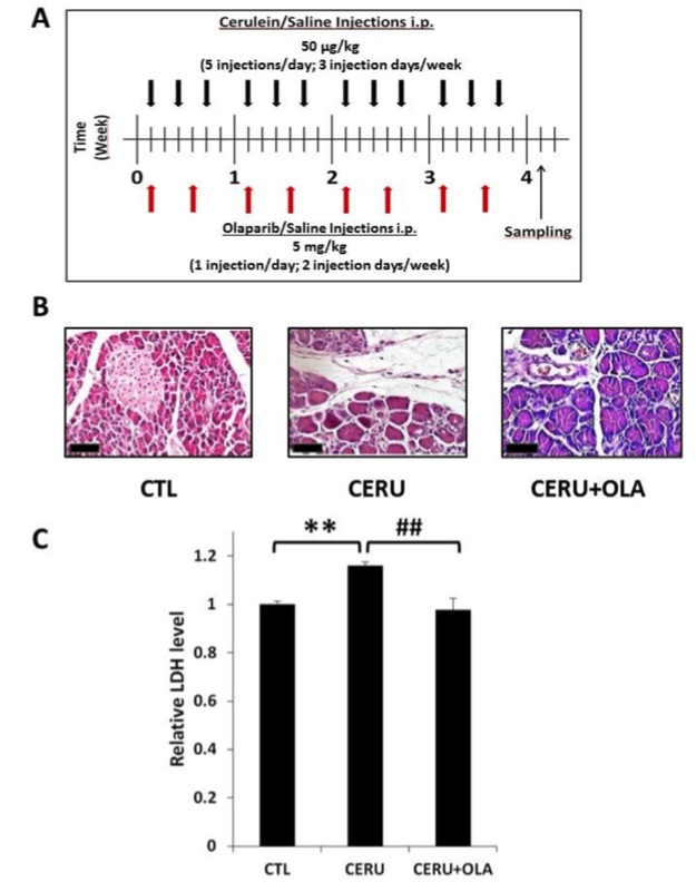 Fig.1 A picture showing the poly (ADP-ribose) polymerase (PARP) inhibitor olaparib reduces pancreatic injury in cerulein-induced chronic pancreatitis. (OA Literature)