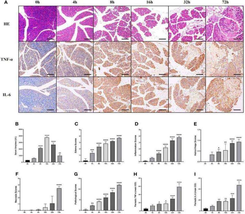Fig.2 Histopathological images of mice induced by partial pancreatic duct ligation and the corresponding results for each scoring parameter. (OA Literature)