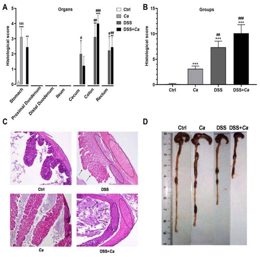 Fig.2 Histopathological examination of the gastrointestinal tract in animals treated with DSS. (OA Literature)