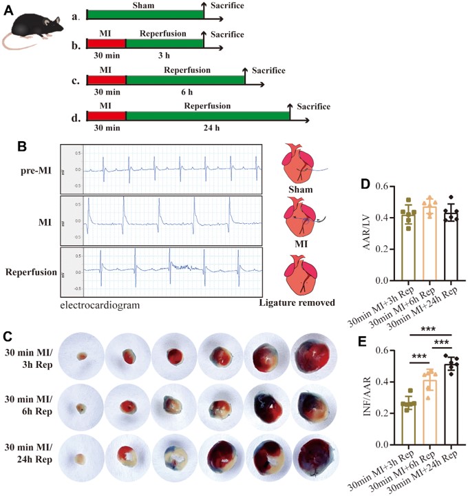 Influence of duration of reperfusion time on infarct size I/R MI model. (OA Literature)