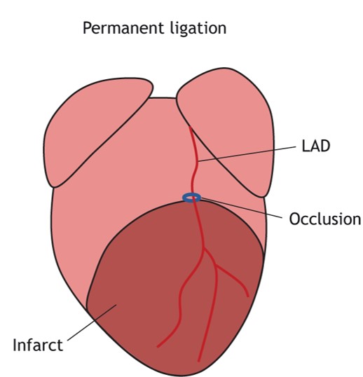 Representative images of myocardial tissue after permanent ischemic, showing infarct size determination. (OA Literature)
