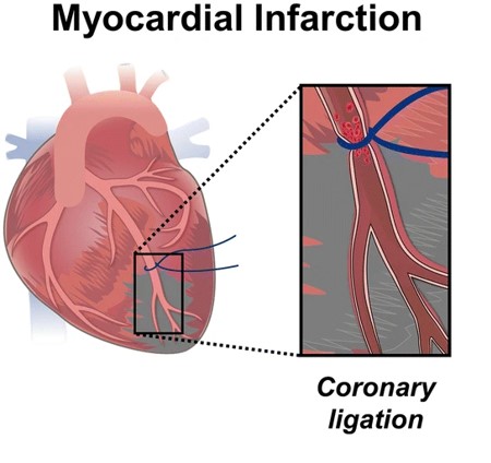 Schematic representation of the MI model. (OA Literature)