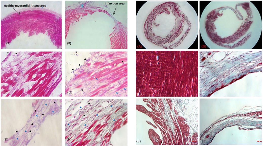 Histopathology using H&E stain and trichrome stain for the mouse myocardial injury model. (OA Literature)