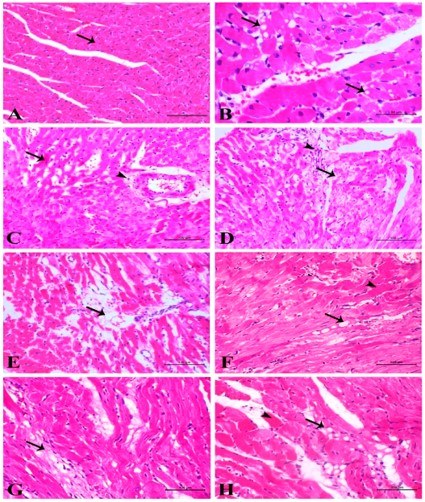 Light microscopic examinations of cardiac myocytes after adriamycin induction. (OA Literature)
