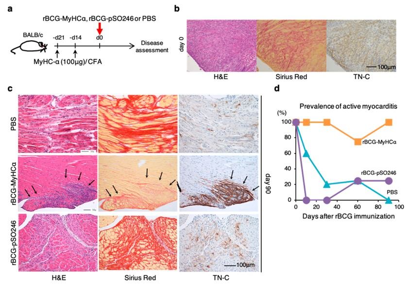 A model of prolonged chronic myocarditis following acute myocarditis. (OA Literature)