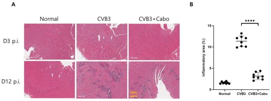 Caboxamycin reduced cardiac inflammation in a CVB3-induced myocarditis mouse model. (OA Literature)