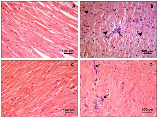 Hematoxylin and eosin staining of heart muscle tissue in CB3V-induced myocarditis mice model. (OA Literature)