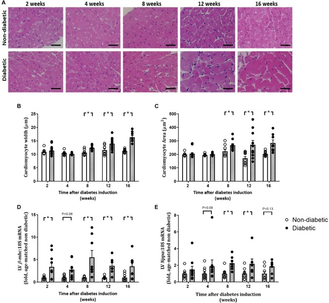 Progression of cardiomyocyte hypertrophy in STZ-induced T1D. (OA Literature)