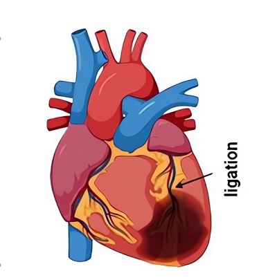 Surgical techniques for coronary artery ligation MI rat HF model. (OA Literature)