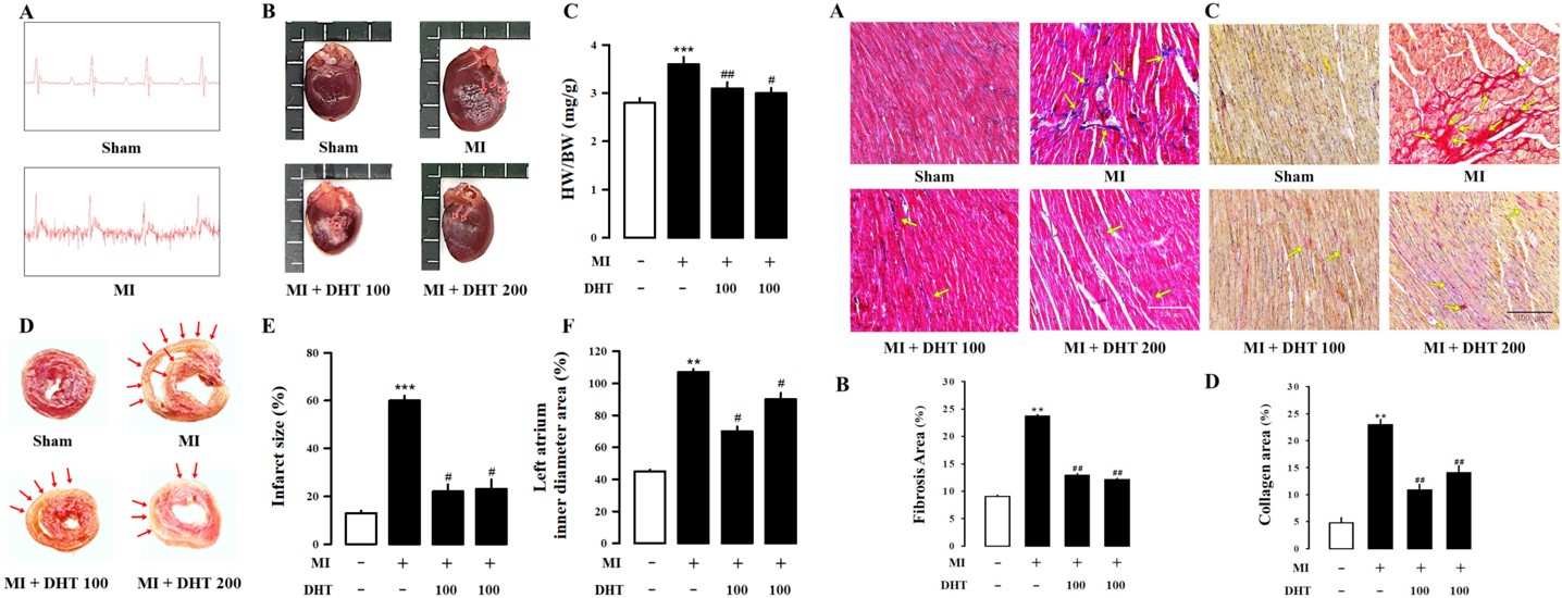 Evaluation of the impact of DHT on infarct size, electrocardiogram, and histopathological changes in rats with MI-induced HF. (OA Literature)
