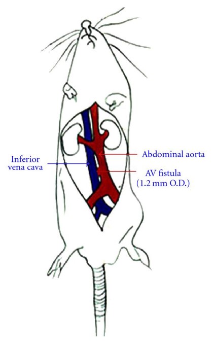 A schematic description of the creation of ACF in rats, an experimental model of volume-overload CHF. (OA Literature)