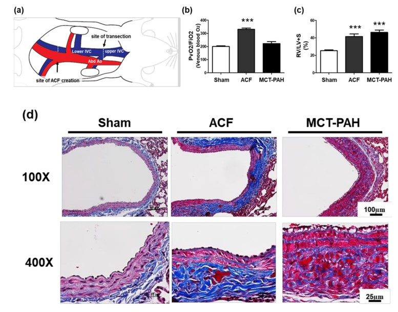 Characterization of the ACF animal model: ACF impacts right heart hypertrophy and collagen accumulation, leading to PA fibrosis. (OA Literature)