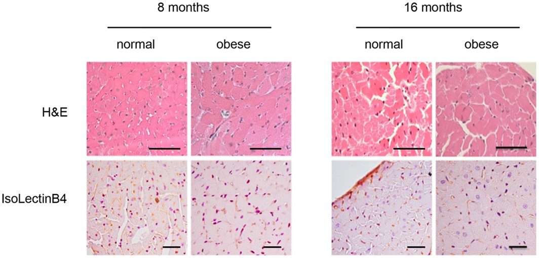 HFD-induced obese mice exhibit cardiac remodelling. (OA Literature)
