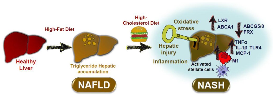 Impact of HFC diet on inflammatory processes associated with non-alcoholic steatohepatitis (NASH). (OA Literature)