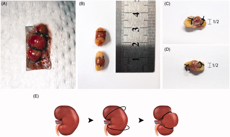 Surgical procedure of conventional 5/6 nephrectomy. (OA Literature)