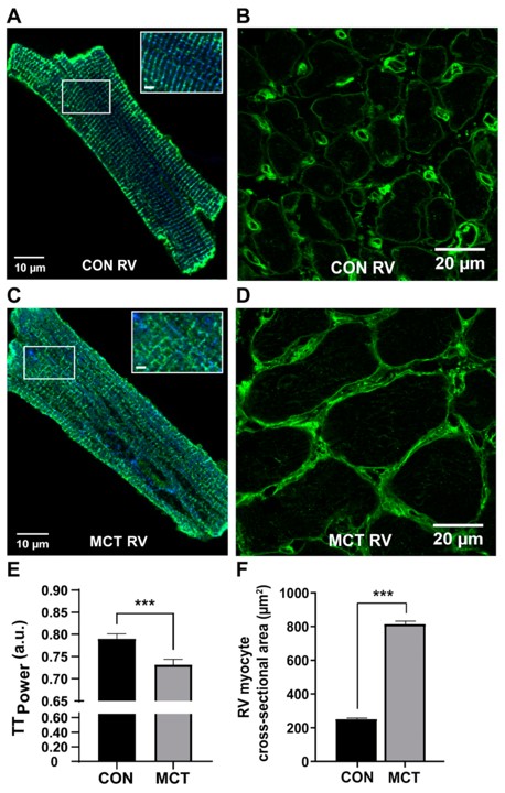 Evidence of RV hypertrophy 4 weeks MCT post-injection. (OA Literature)