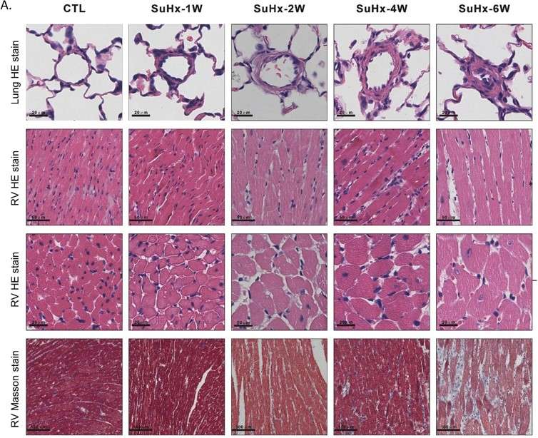 Changes in the pulmonary vascular medial wall thickness and RV lesions in SuHx rats. (OA Literature)