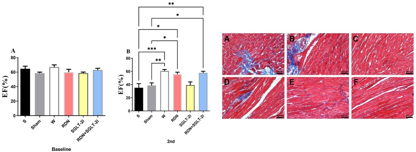 Significant improvement in the ejection fraction and lower myocardial fibrosis area under RDN combined with SGLT-2i treatment. (OA Literature)