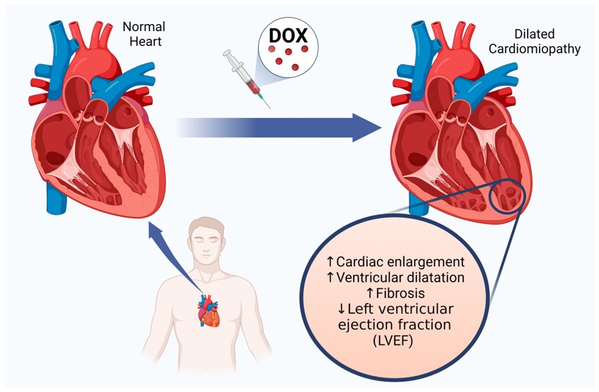 Late cardiotoxic effects of Dox. (OA Literature)