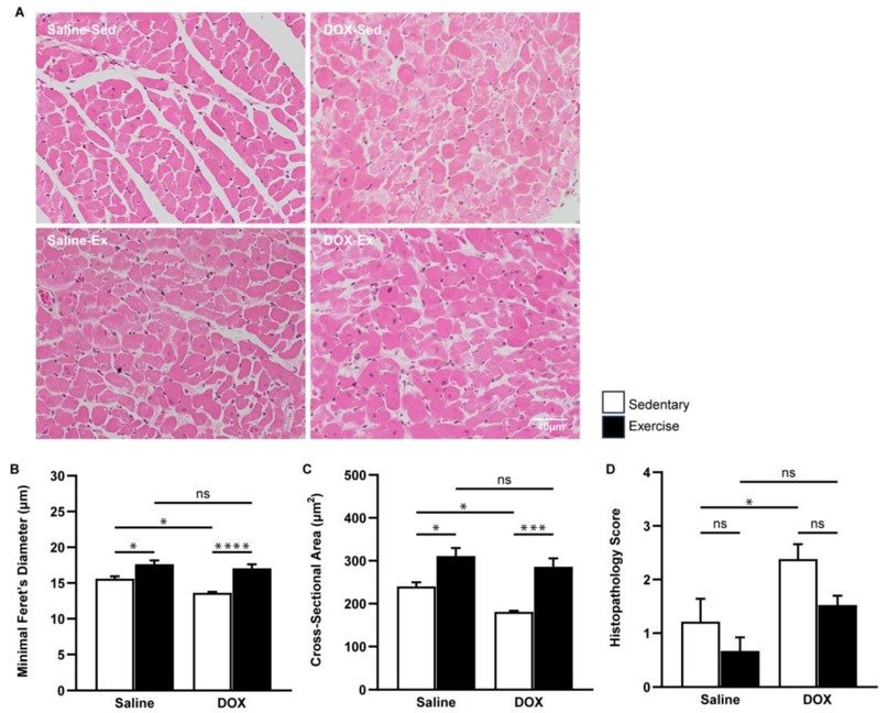 Cardiac morphology associated with Dox treatment. (OA Literature)