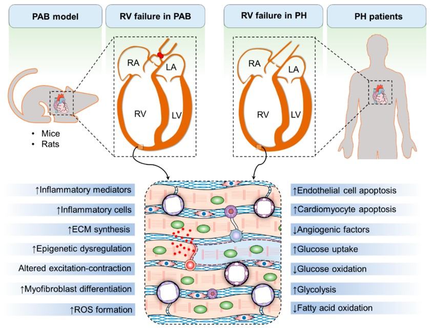The PAB model of RHF recapitulates many features of RHF observed in pulmonary hypertension (PH) patients. (OA Literature)