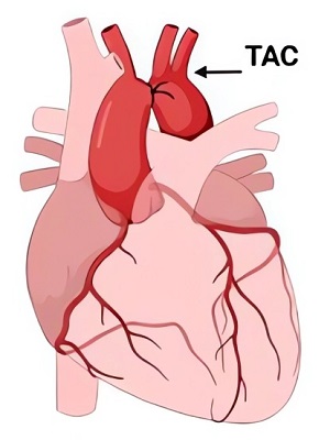 Surgical techniques for the AoS rat HF model. (OA Literature)