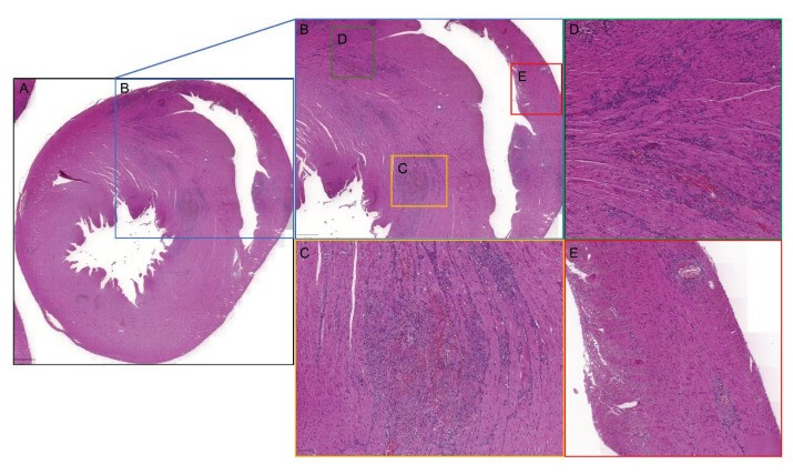 Histological evaluation of myocardial fibrosis in the rat DOCA/Salt rat model. (OA Literature)