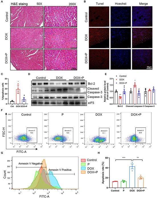 Study of cardiomyocyte apoptosis in the doxorubicin-induced left HF model. (OA Literature)