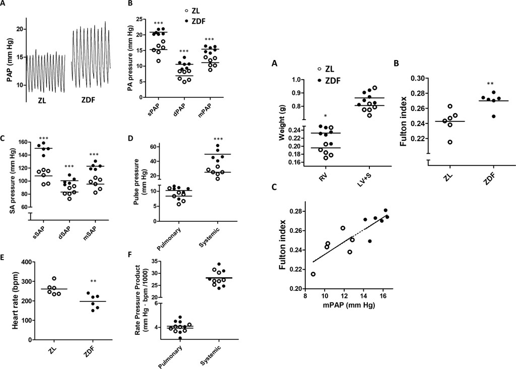Increased pulmonary and systemic arterial pressure and right ventricular hypertrophy in ZDF rats. (OA Literature)